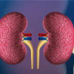 Nephrological Excellence: Kidney Care in the Heart of Kanpur