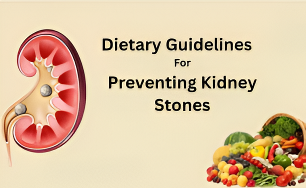 Dietary Guidelines for Preventing Kidney Stones