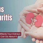 Lupus Nephritis: Modern Managements And Protecting Overall Health