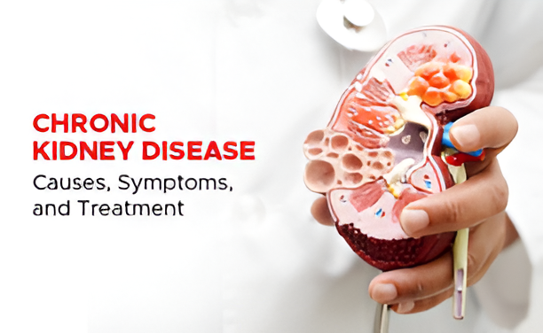 Chronic Kidney Disease